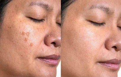 Advanced Skin Care Treatments at Revive